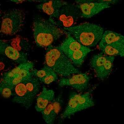 Immunocytochemistry/ Immunofluorescence: UCH-L1/PGP9.5 Antibody (13C4) [NBP2-29420]