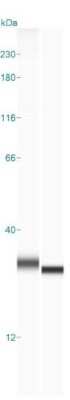 Simple Western: UCH-L1/PGP9.5 Antibody (13C4) [NBP2-29420]