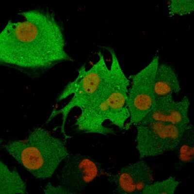 Immunocytochemistry/ Immunofluorescence: UCH-L1/PGP9.5 Antibody (31A3) [NB600-1160]