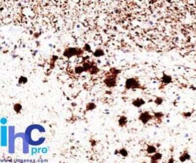 Immunohistochemistry-Paraffin: UCH-L1/PGP9.5 Antibody (31A3) [NB600-1160]