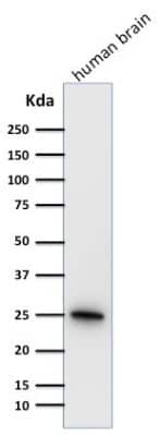 Western Blot: UCH-L1/PGP9.5 Antibody (31A3) [NB600-1160]