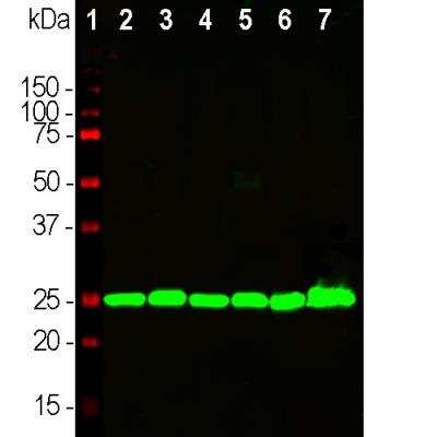 Western Blot: UCH-L1/PGP9.5 Antibody (BH7) [NB110-58869]