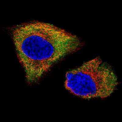 Immunocytochemistry/ Immunofluorescence: UCH-L1/PGP9.5 Antibody (CL3210) [NBP2-46621]