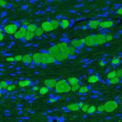 Immunohistochemistry: UCH-L1/PGP9.5 Antibody (CL3210) [NBP2-46621]