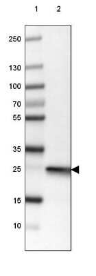 Western Blot: UCH-L1/PGP9.5 Antibody (CL3210) [NBP2-46621]