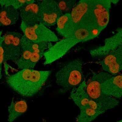 Immunocytochemistry/ Immunofluorescence: UCH-L1/PGP9.5 Antibody (SPM574) - Azide and BSA Free [NBP2-34807]