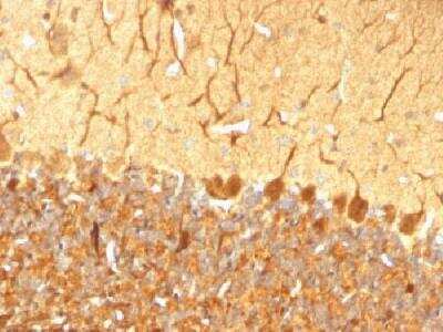 Immunohistochemistry-Paraffin: UCH-L1/PGP9.5 Antibody (SPM574) [NBP2-32895]