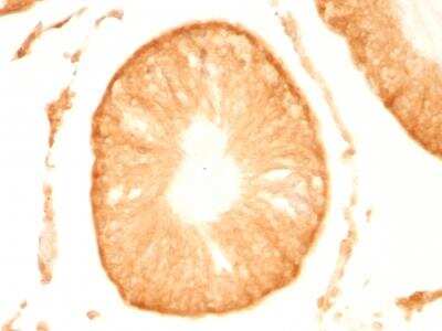 Immunohistochemistry-Paraffin: UCH-L1/PGP9.5 Antibody (UCHL1/775) - Azide and BSA Free [NBP2-47932]