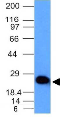 Western Blot: UCH-L1/PGP9.5 Antibody (UCHL1/841) [NBP2-44796]