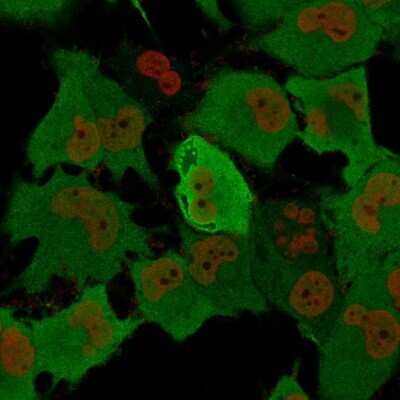 Immunocytochemistry/ Immunofluorescence: UCH-L1/PGP9.5 Antibody (rUCHL1/775) - Azide and BSA Free [NBP2-75775]