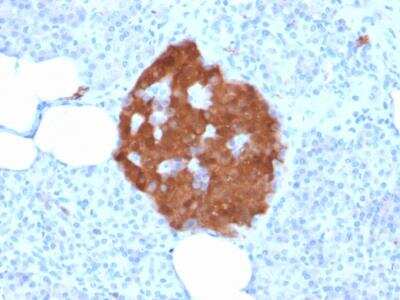 Immunohistochemistry-Paraffin: UCH-L1/PGP9.5 Antibody (rUCHL1/775) [NBP2-75773]