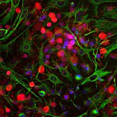 Immunocytochemistry/ Immunofluorescence: UCH-L1/PGP9.5 Antibody [NB110-58872]