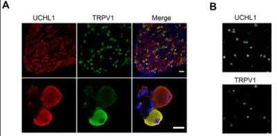 Immunocytochemistry/ Immunofluorescence: UCH-L1/PGP9.5 Antibody [NB110-58872]