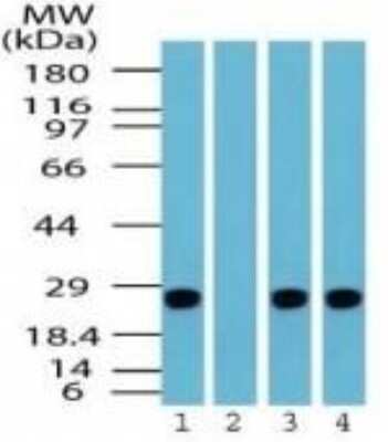 Western Blot: UCH-L1/PGP9.5 Antibody [NBP2-24719]