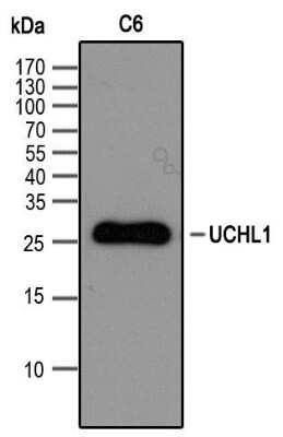 Western Blot: UCH-L1/PGP9.5 Antibody [NBP2-24719]