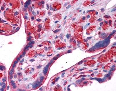 Immunohistochemistry-Paraffin: UCH-L3 Antibody [NBP1-55316]