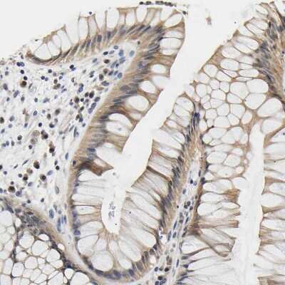 Immunohistochemistry-Paraffin: UCH-L3 Antibody [NBP1-86037]