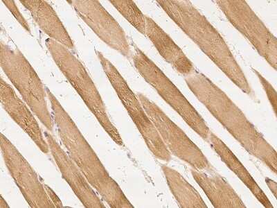 Immunohistochemistry-Paraffin: UCH-L3 Antibody [NBP2-99525]