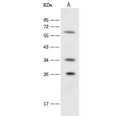 Western Blot: UCH-L3 Antibody [NBP2-99525]