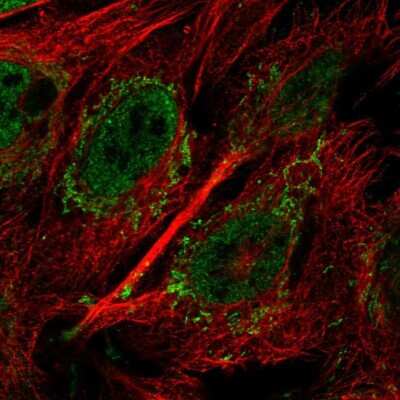 Immunocytochemistry/ Immunofluorescence: UCH-L5/UCH37 Antibody [NBP2-57955]