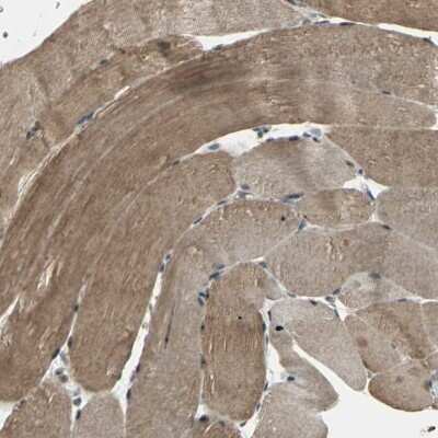 Immunohistochemistry-Paraffin: UCH-L5/UCH37 Antibody [NBP1-85656]