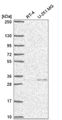 Western Blot: UCH-L5/UCH37 Antibody [NBP2-57955]