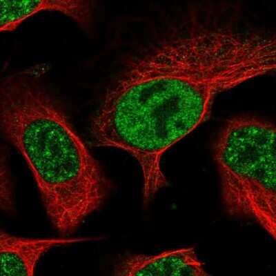 Immunocytochemistry/ Immunofluorescence: UCK Antibody [NBP2-47587]
