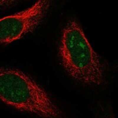 Immunocytochemistry/ Immunofluorescence: UCK Antibody [NBP3-17453]