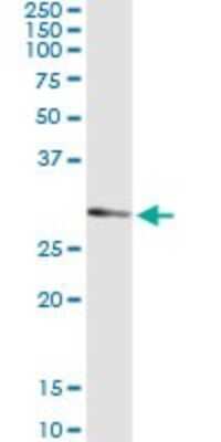 Western Blot: UCK2 Antibody (1G12) [H00007371-M03]