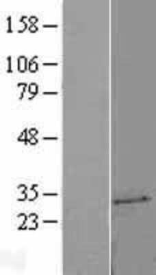 Western Blot: UCK2 Overexpression Lysate [NBL1-17580]