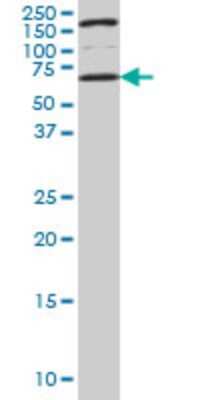 Western Blot: UCKL1 Antibody (8D4) [H00054963-M01]