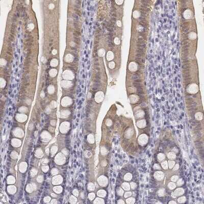 Immunohistochemistry-Paraffin: UCN2 Antibody [NBP2-57622]