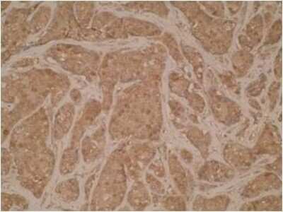 Immunohistochemistry: UCP1 Antibody (Vab12 P4B12*A12) - BSA Free [NBP2-50343]
