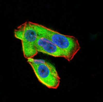 Immunocytochemistry/ Immunofluorescence: UCP2 Antibody (3F1B9) - BSA Free [NBP2-52582]
