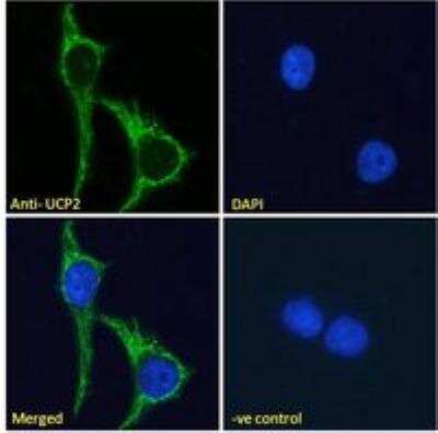 Immunocytochemistry/ Immunofluorescence: UCP2 Antibody [NB100-59742]