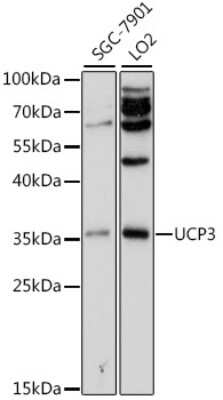 Western Blot: UCP3 AntibodyAzide and BSA Free [NBP2-94663]