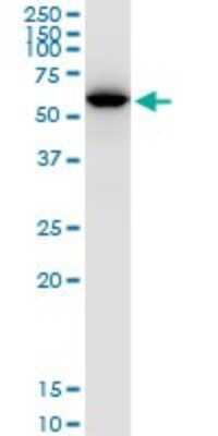 Western Blot: UDP glucose dehydrogenase Antibody [H00007358-B01P]