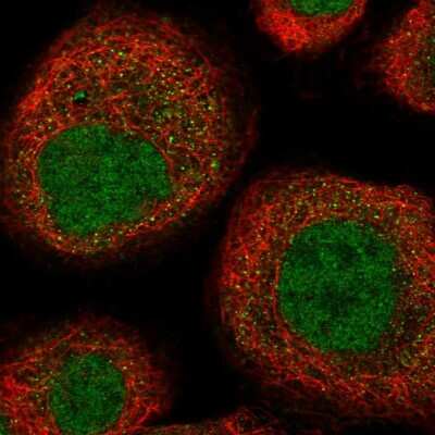Immunocytochemistry/ Immunofluorescence: UEVLD Antibody [NBP1-92561]