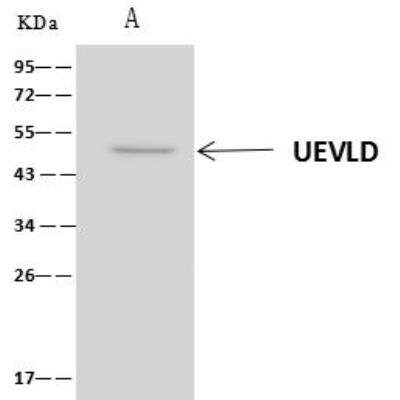 Immunoprecipitation: UEVLD Antibody [NBP3-05953]