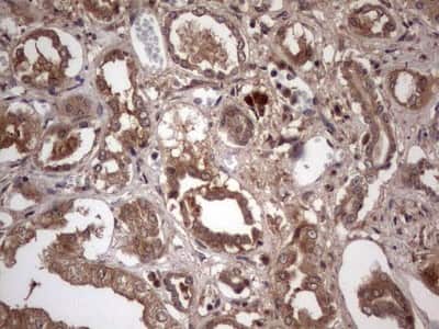 Immunohistochemistry: UFD1L Antibody (OTI8G6) [NBP2-46289]
