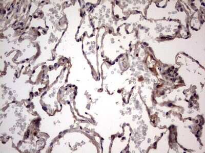 Immunohistochemistry: UFD1L Antibody (OTI8G6) [NBP2-46289]