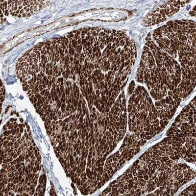 Immunohistochemistry-Paraffin: UFD1L Antibody [NBP1-86879]