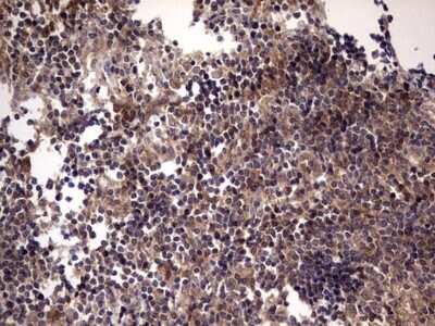 Immunohistochemistry: UFD1L Antibody (OTI8G6) - Azide and BSA Free [NBP2-74781]