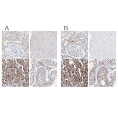 Immunohistochemistry-Paraffin: UFL1 Antibody [NBP1-90691]