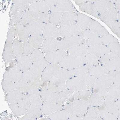Immunohistochemistry-Paraffin: UFL1 Antibody [NBP1-90692]