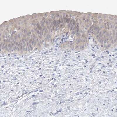 Immunohistochemistry-Paraffin: UFL1 Antibody [NBP1-90693]