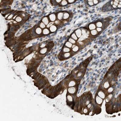 Immunohistochemistry-Paraffin: UFM1 Activating Enzyme/UBA5 Antibody [NBP1-82087]