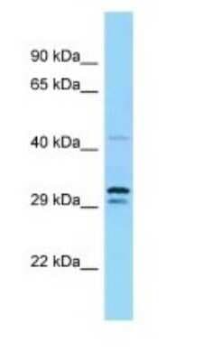 Western Blot: UFM1 Activating Enzyme/UBA5 Antibody [NBP1-98392]