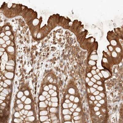 Immunohistochemistry-Paraffin: UFSP1 Antibody [NBP1-80643]
