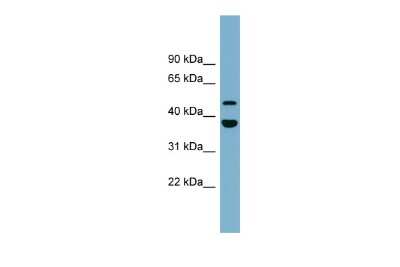 Western Blot: UFSP2 Antibody [NBP2-88553]